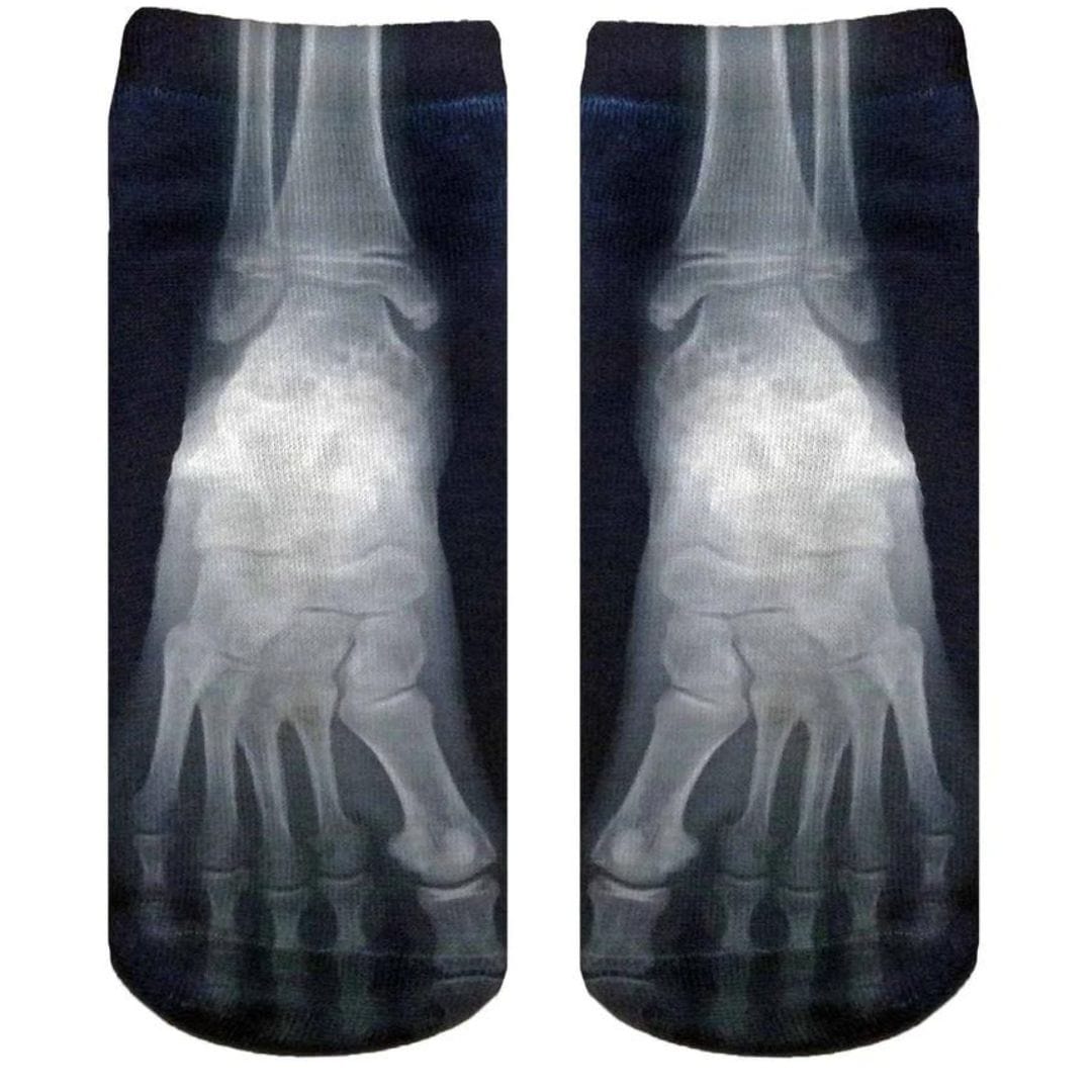 X Ray Ankle Socks Black