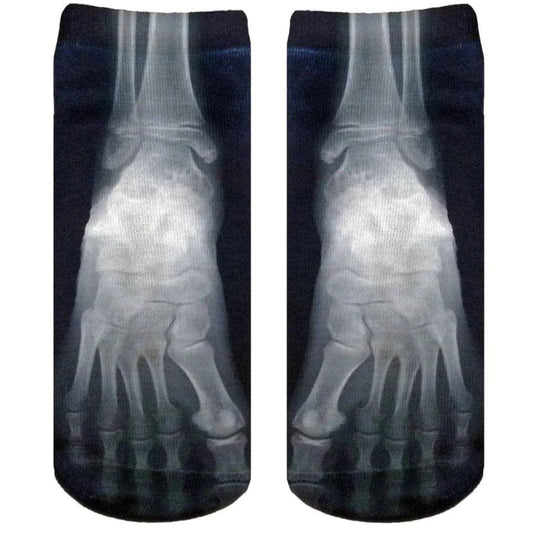 X Ray Ankle Socks Black